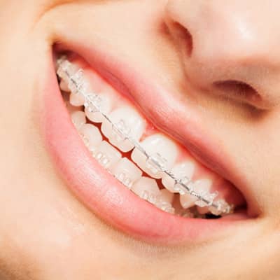 Orthodontist in Brick Township NJ | Brick Township orthodontist | Imagination Orthodontics