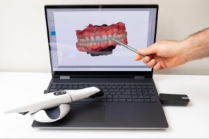 Technology Trends in Orthodontics