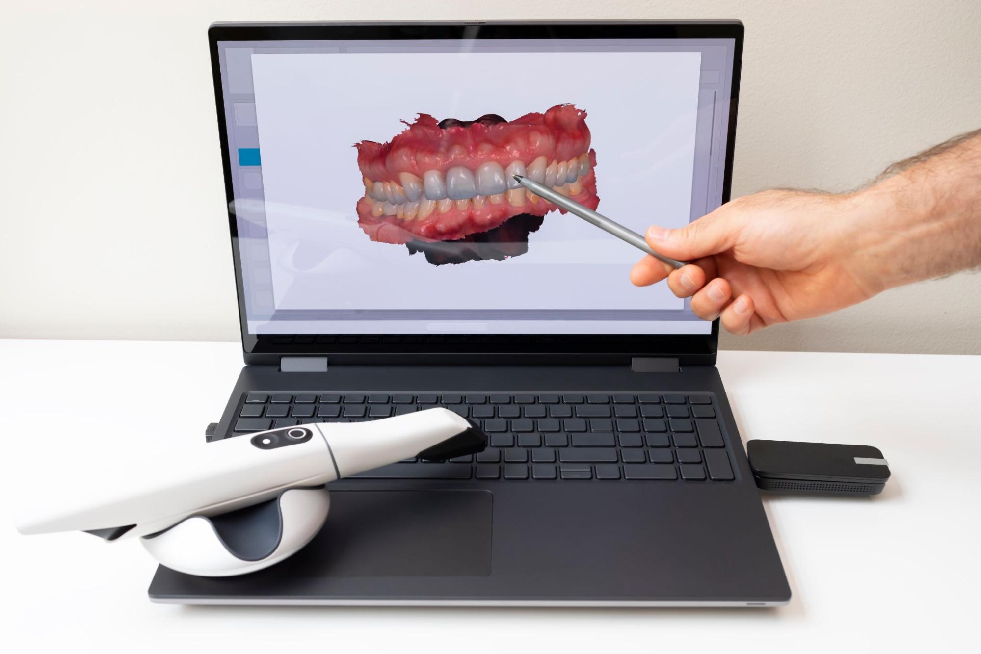 Technology Trends in Orthodontics